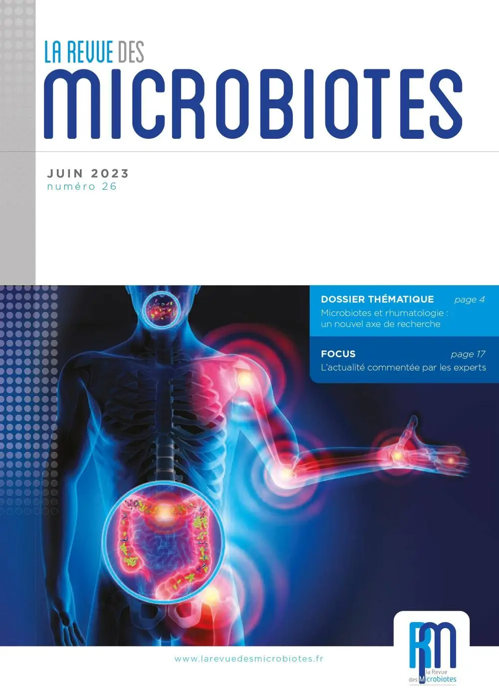 Microbiotes et rhumatologie : un nouvel axe de recherche